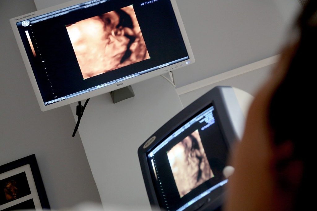 Placówka RTG i USG: Kluczowe Aspekty Diagnostyki Obrazowej w Służbie Zdrowia