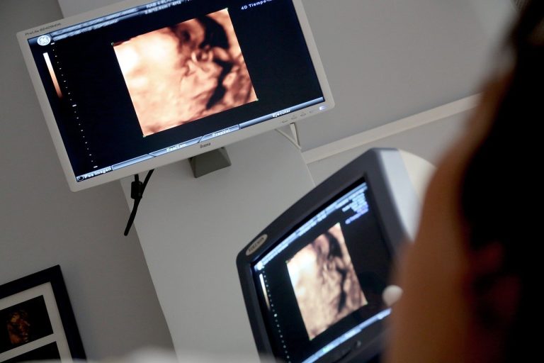 Placówka RTG i USG: Kluczowe Aspekty Diagnostyki Obrazowej w Służbie Zdrowia